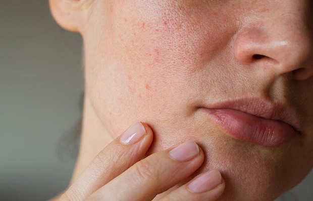 Massage mặt giúp chống thô ráp và sần sùi