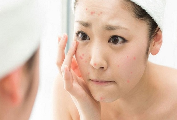 Massage mặt giúp giảm mụn và sẹo mụn